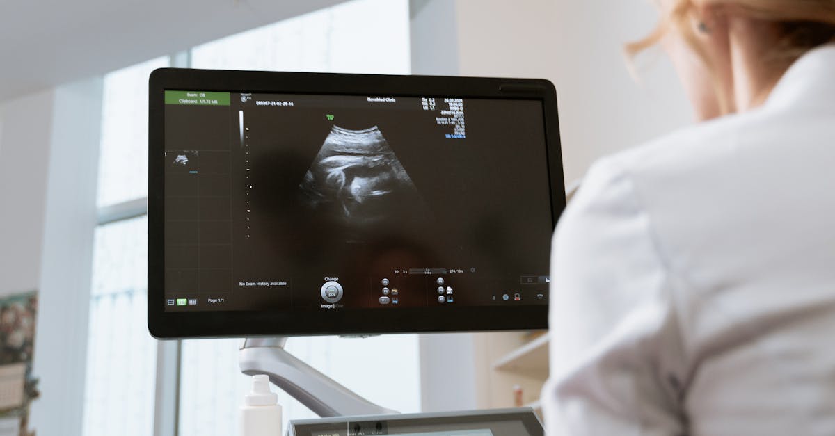 Kdy je čas navštívit gynekologa a co čekat na první prohlídce